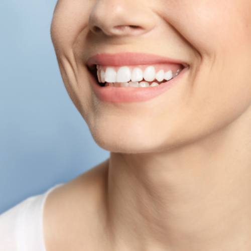 Close up of a woman's smile with white teeth